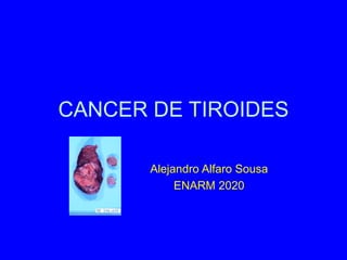CANCER DE TIROIDES
Alejandro Alfaro Sousa
ENARM 2020
 