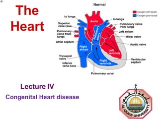 The
Heart
Lecture IV
Congenital Heart disease
 