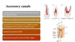 Accessory canals
Leading laterally from the radicular pulp into the
periodontal tissue.
Present in the apical third of the root sheath cells
Formed due to premature loss of HERS or when
developing root encounters a blood vessel.
Overall occurrence is 33%
May also be present at the furcation region
 