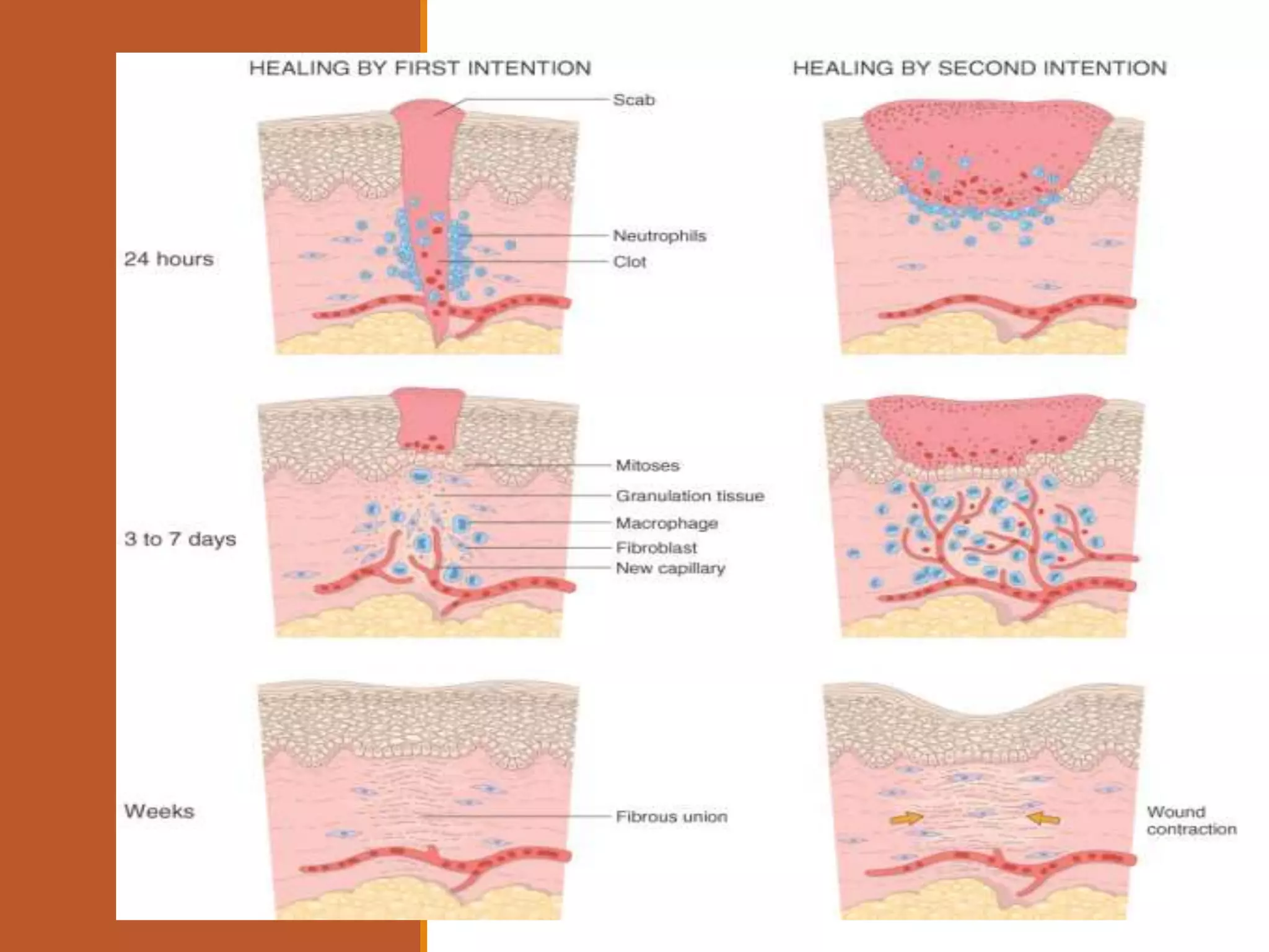 4.Wound Healing.pptx