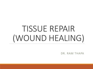 TISSUE REPAIR
(WOUND HEALING)
DR. RAM THAPA
 