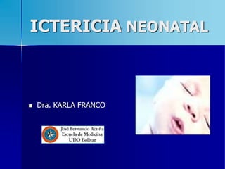 ICTERICIA NEONATAL
 Dra. KARLA FRANCO
 