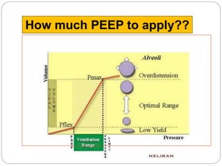 Peep Explained 4.2-Mechanical-Ventilation-Part-II2.ppt
