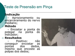 Teste de Preensão em Pinça
 Indicação
- Aprisionamento ou
encarceramento do nervo
mediano;
 Método
- Encostar a ponta do
polegar na ponta do
indicador;
 Resultados
- Positivo: não
conseguir encostar as
pontas dos dedos,
mesmo que encoste as
polpas dos dedos;
 
