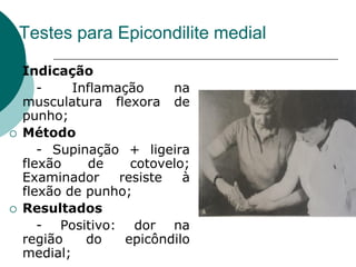 Testes para Epicondilite medial
 Indicação
- Inflamação na
musculatura flexora de
punho;
 Método
- Supinação + ligeira
flexão de cotovelo;
Examinador resiste à
flexão de punho;
 Resultados
- Positivo: dor na
região do epicôndilo
medial;
 
