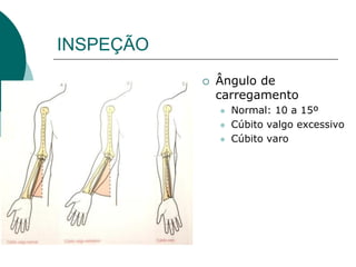 INSPEÇÃO
 Ângulo de
carregamento
 Normal: 10 a 15º
 Cúbito valgo excessivo
 Cúbito varo
 