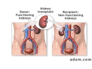 4.1ª Aula Sistema Renal.pdf