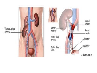 4.1ª Aula Sistema Renal.pdf