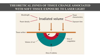 THEORETICAL ZONES OF TISSUE CHANGE ASSOCIATED
WITH SOFT TISSUE EXPOSURE TO LASER LIGHT
 
