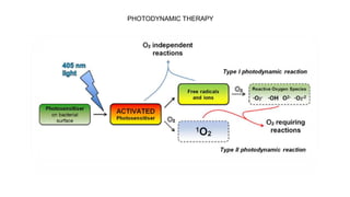 PHOTODYNAMIC THERAPY
 