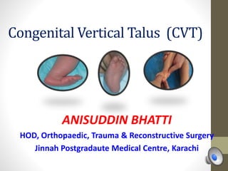 Congenital Vertical Talus (CVT)
ANISUDDIN BHATTI
HOD, Orthopaedic, Trauma & Reconstructive Surgery
Jinnah Postgradaute Medical Centre, Karachi
 