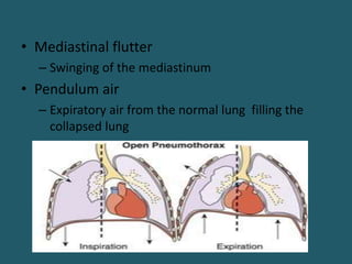 • Mediastinal flutter
– Swinging of the mediastinum
• Pendulum air
– Expiratory air from the normal lung filling the
collapsed lung
 