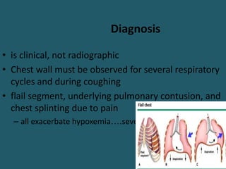 Diagnosis
• is clinical, not radiographic
• Chest wall must be observed for several respiratory
cycles and during coughing
• flail segment, underlying pulmonary contusion, and
chest splinting due to pain
– all exacerbate hypoxemia….severe RD
 