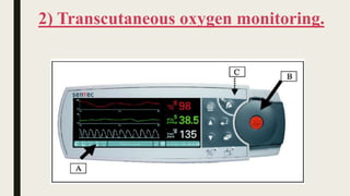 4.Intensive care monitoring system .pptx