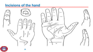 4. Hand Injury Management 2gggggg021.pptx