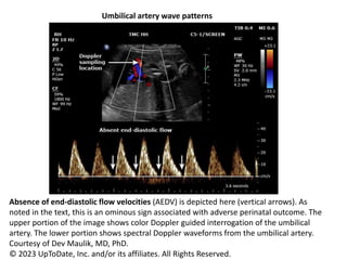 4. FETAL SURVEILENCE AND INTRAPARTUM FETAL MONITORING - Copy.pptx