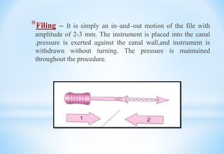 *Filing – It is simply an in–and–out motion of the file with
amplitude of 2-3 mm. The instrument is placed into the canal
,pressure is exerted against the canal wall,and instrument is
withdrawn without turning. The pressure is maintained
throughout the procedure.
 
