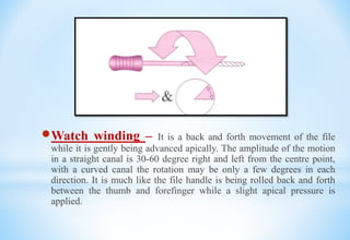 Watch winding – It is a back and forth movement of the file
while it is gently being advanced apically. The amplitude of the motion
in a straight canal is 30-60 degree right and left from the centre point,
with a curved canal the rotation may be only a few degrees in each
direction. It is much like the file handle is being rolled back and forth
between the thumb and forefinger while a slight apical pressure is
applied.
 