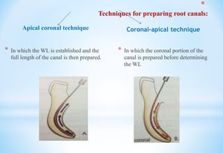 Apical coronal technique
* In which the WL is established and the
full length of the canal is then prepared.
Coronal-apical technique
* In which the coronal portion of the
canal is prepared before determining
the WL
*
Techniques for preparing root canals:
 