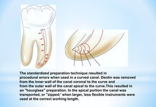 The standardized preparation technique resulted in
procedural errors when used in a curved canal. Dentin was removed
from the inner wall of the canal coronal to the curve and
from the outer wall of the canal apical to the curve.This resulted in
an "hourglass" preparation. In the apical portion the canal was
transported, or "zipped;' when larger, less flexible instruments were
used at the correct working length.
 