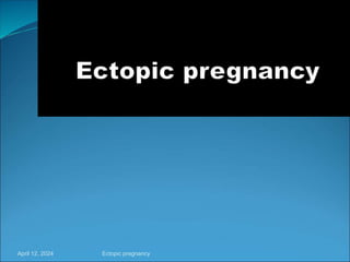 April 12, 2024 Ectopic pregnancy
 
