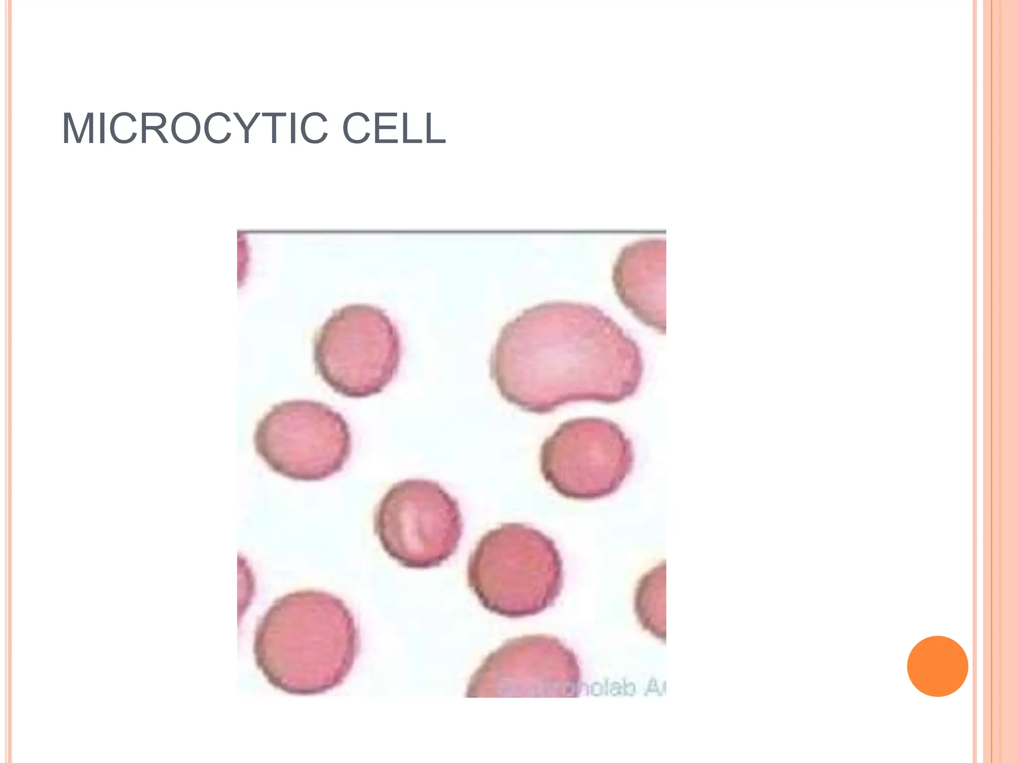 MICROCYTIC CELL
 