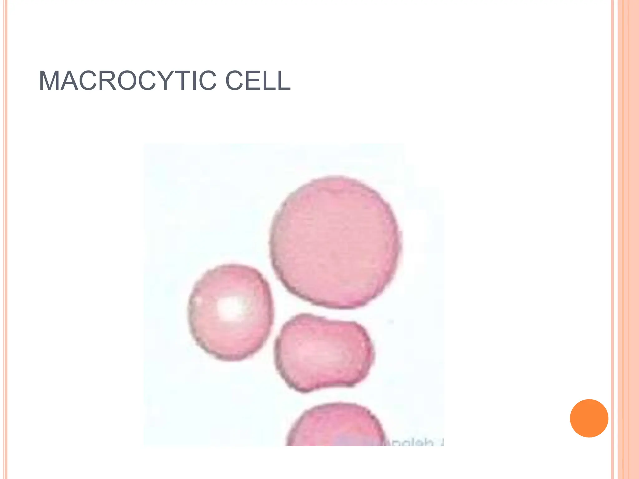 MACROCYTIC CELL
 