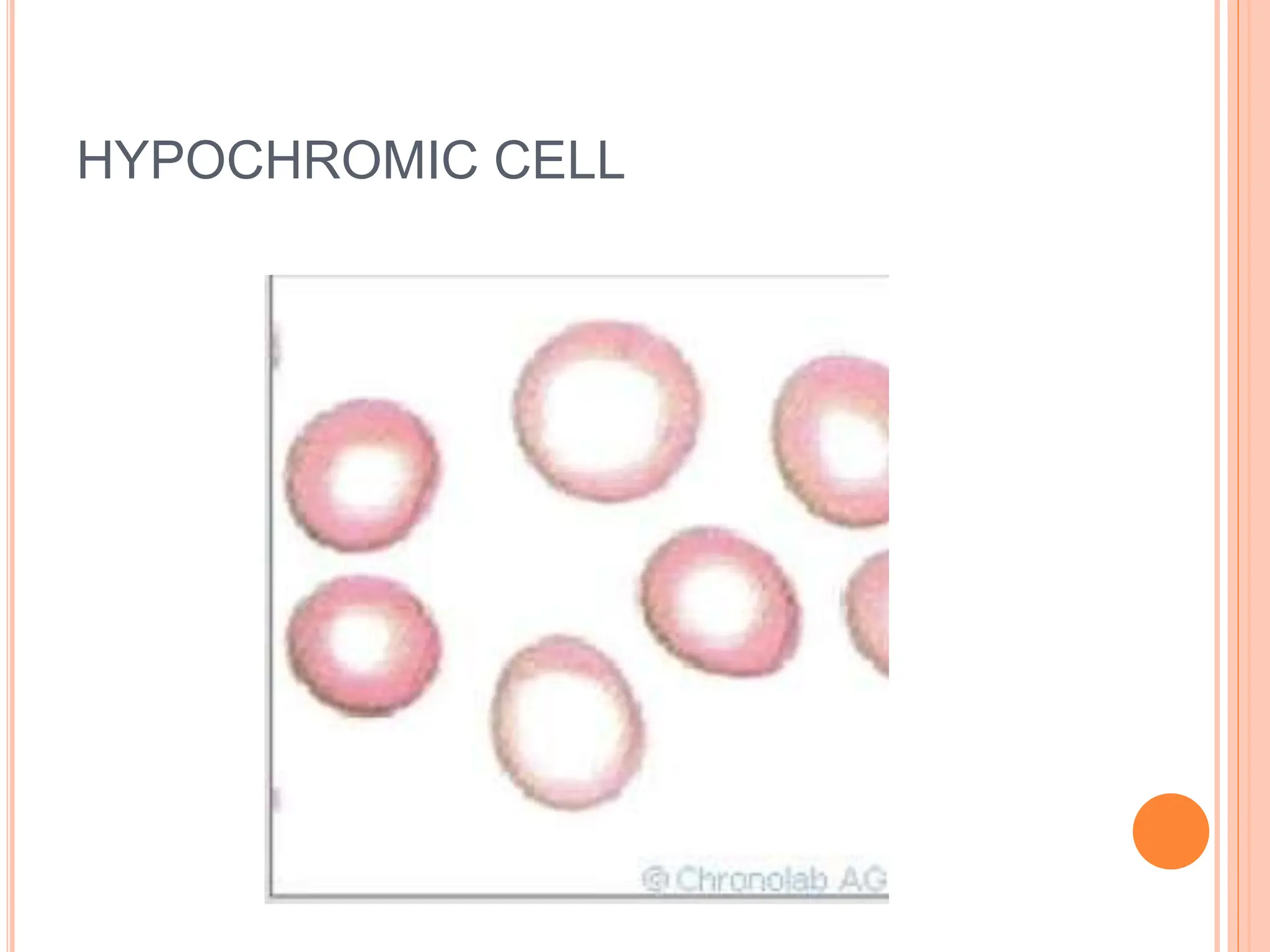HYPOCHROMIC CELL
 