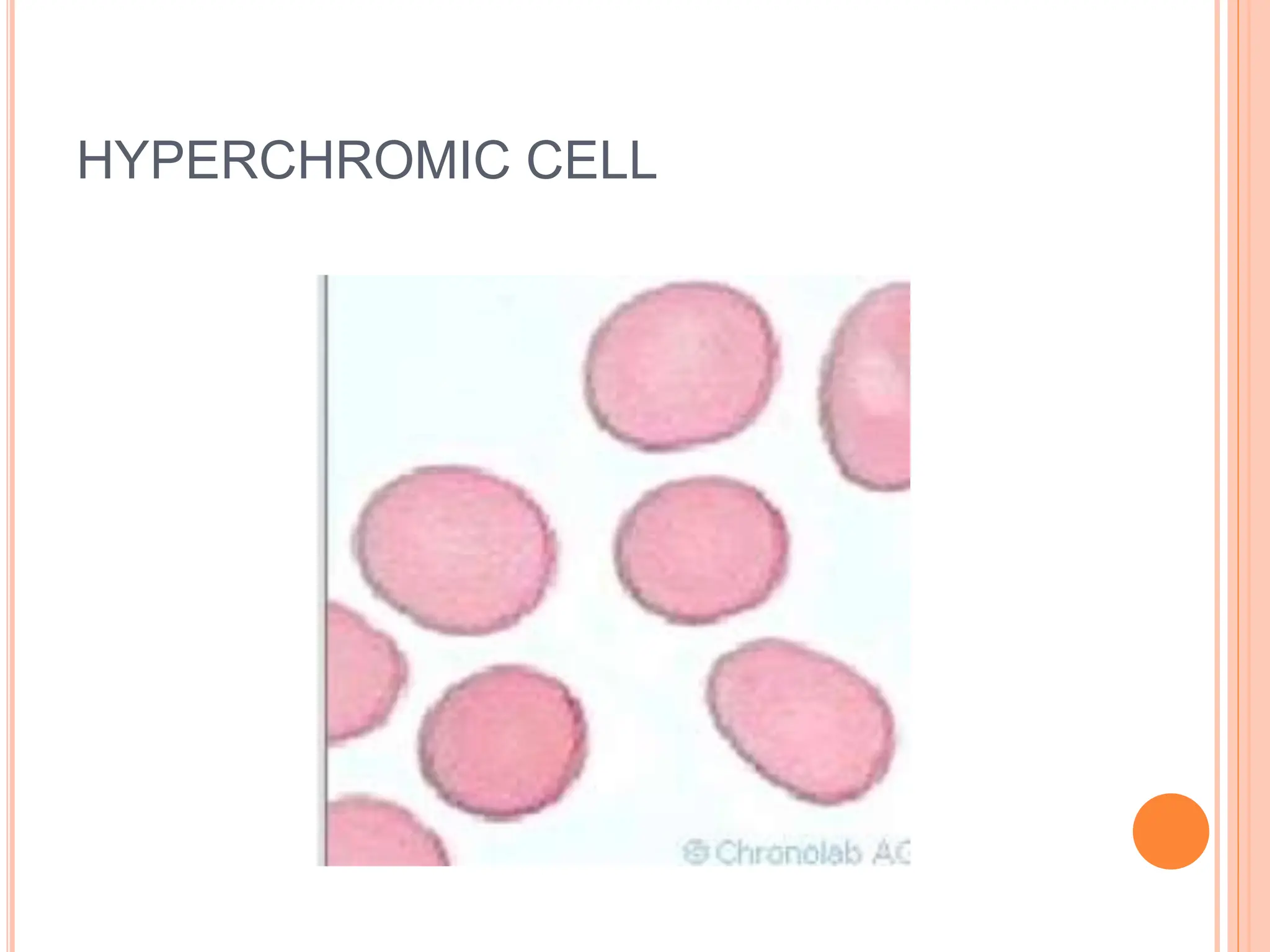 HYPERCHROMIC CELL
 