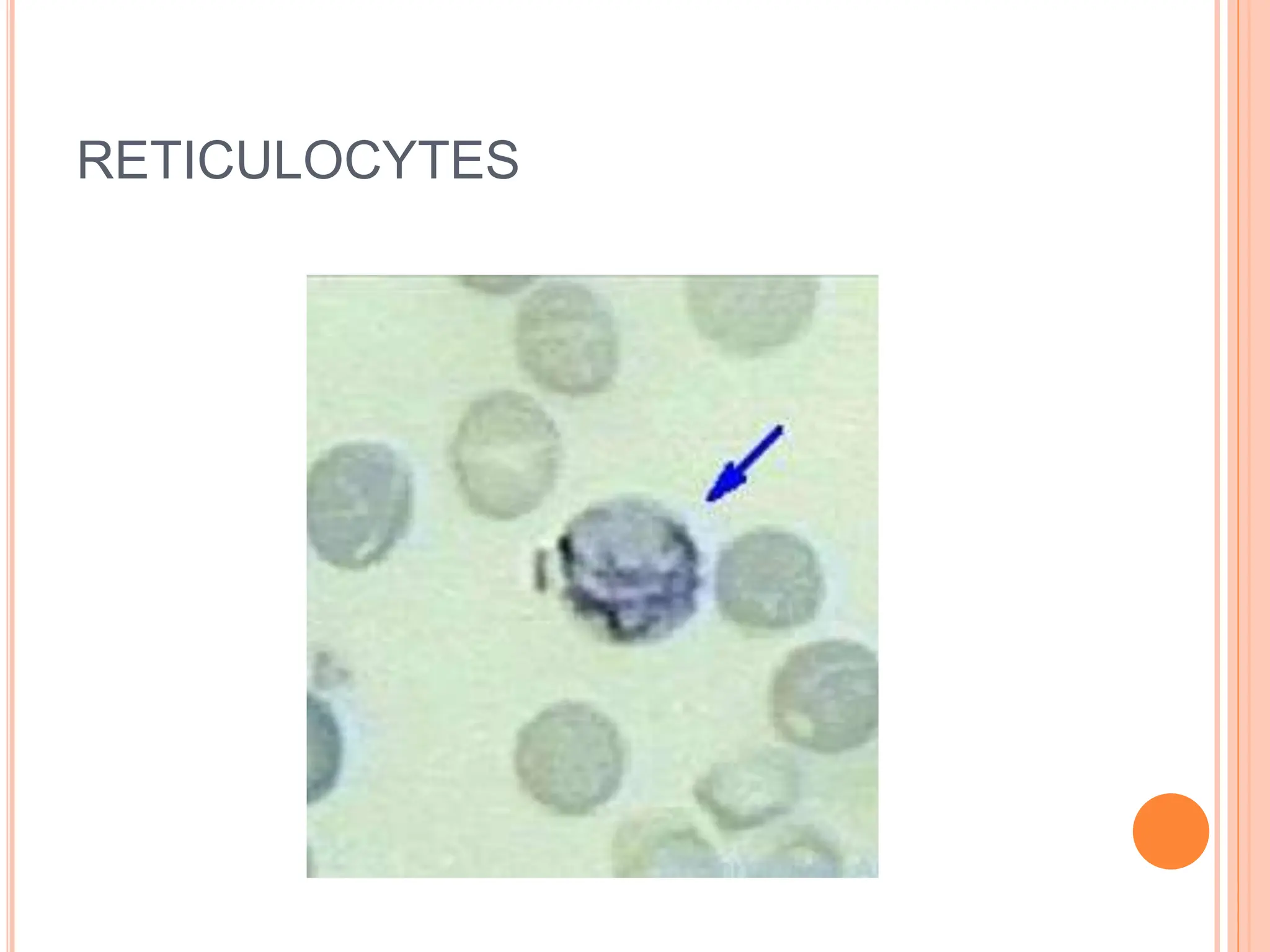 RETICULOCYTES
 