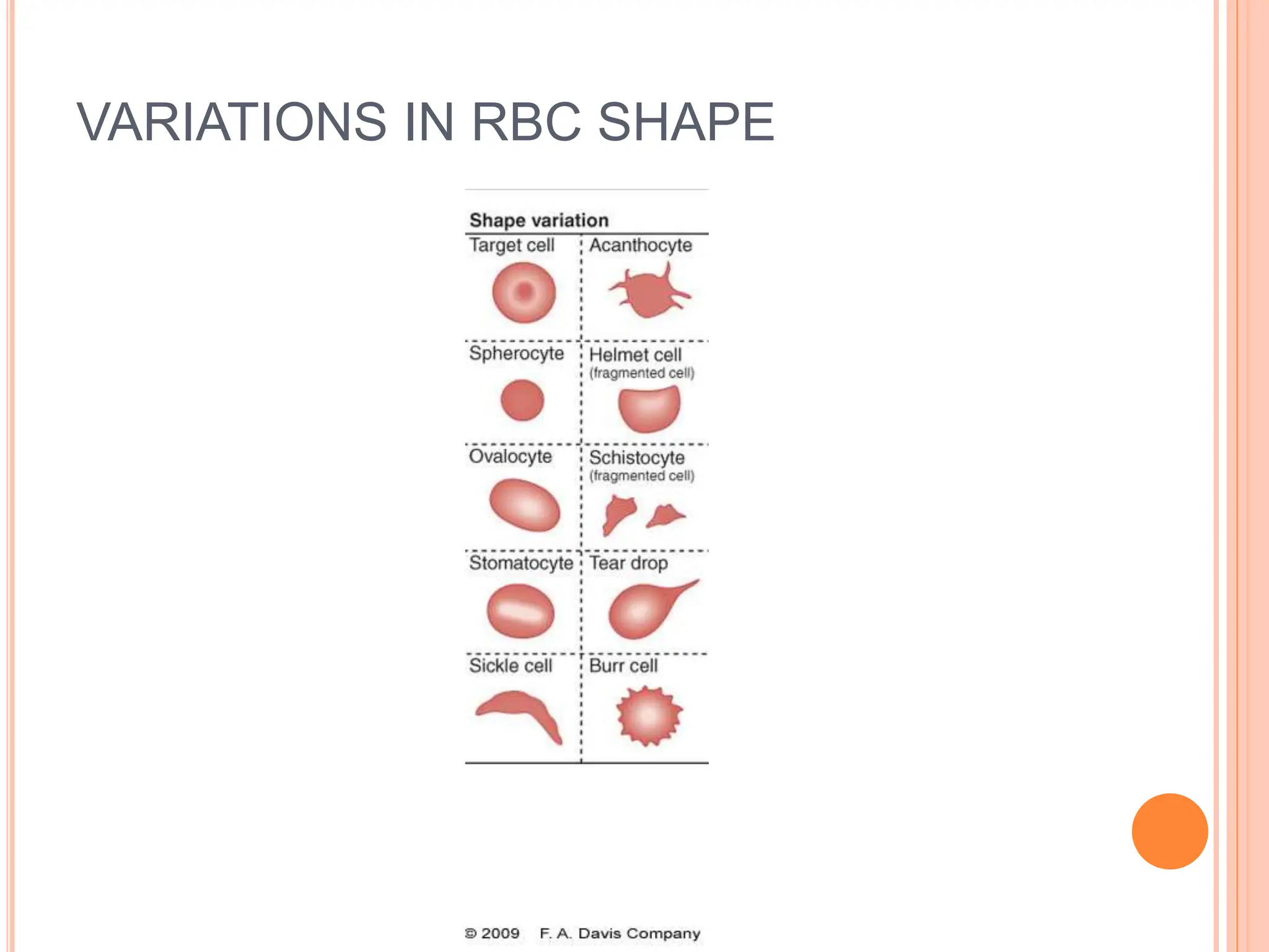 VARIATIONS IN RBC SHAPE
 