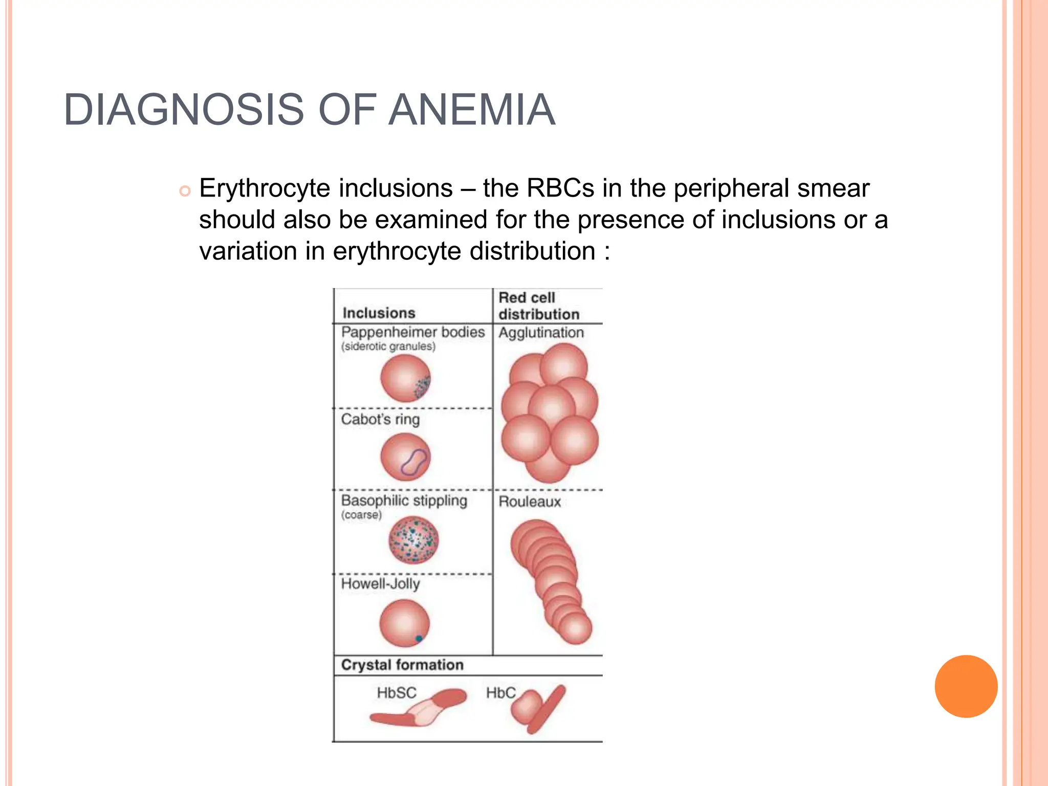 DIAGNOSIS OF ANEMIA
 Erythrocyte inclusions – the RBCs in the peripheral smear
should also be examined for the presence of inclusions or a
variation in erythrocyte distribution :
 