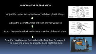 4. BALANCED OCCLUSION balanced occlusion | PPTX