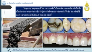 สถาบันส่งเสริมการสอนวิทยาศาสตร์และเทคโนโลยี
ครูวิชัยลิขิตพรรักษ์ ตำแหน่งครู วิทยฐำนะครูชำนำญกำรพิเศษ(คศ.3)กลุ่มสำระกำรเรียนรู้วิทยำศำสตร์และเทคโนโลยี โรงเรียนวัดรำชบพิธ สพม.กท.1
วัสดุผสม (Composite) มีวัสดุ 2 ประเภทขึ้นไปโดยองค์ประกอบเคมีต่ำงกันไม่เป็น
เนื้อเดียวกัน กำรผสมกันระหว่ำงวัสดุในระดับที่ตำสำมำรถสังเกตเห็นได้ เช่น คอนกรีตที่ใช้
ก่อสร้ำงประกอบด้วยปูนซีเมนต์ ทรำย หิน และ น้ำ
 