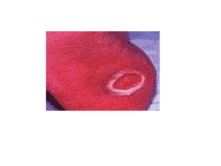 4. Skin manifestations of the systemic diseases in processes and ...