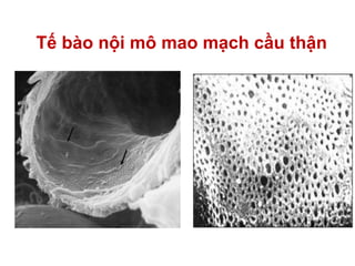 Tế bào nội mô mao mạch cầu thận
 