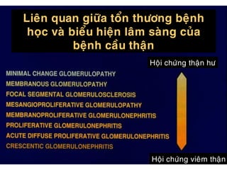 Lieân quan giöõa toån thöông beänh
hoïc vaø bieåu hieän laâm saøng cuûa
beänh caàu thaän
Hoäi chöùng thaän hö
Hoäi chöùng vieâm thaän
 