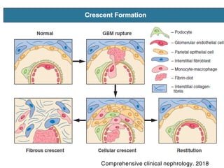 Comprehensive clinical nephrology. 2018
 