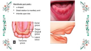 4. development of occlusion seminar.pptx