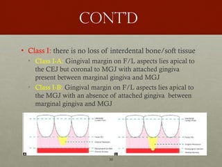 30
Cont’d
• Class I: there is no loss of interdental bone/soft tissue
• Class I-A: Gingival margin on F/L aspects lies apical to
the CEJ but coronal to MGJ with attached gingiva
present between marginal gingiva and MGJ
• Class I-B: Gingival margin on F/L aspects lies apical to
the MGJ with an absence of attached gingiva between
marginal gingiva and MGJ
 