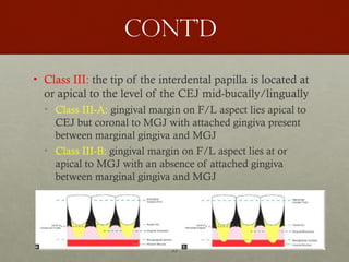 33
Cont’d
• Class III: the tip of the interdental papilla is located at
or apical to the level of the CEJ mid-bucally/lingually
• Class III-A: gingival margin on F/L aspect lies apical to
CEJ but coronal to MGJ with attached gingiva present
between marginal gingiva and MGJ
• Class III-B: gingival margin on F/L aspect lies at or
apical to MGJ with an absence of attached gingiva
between marginal gingiva and MGJ
 