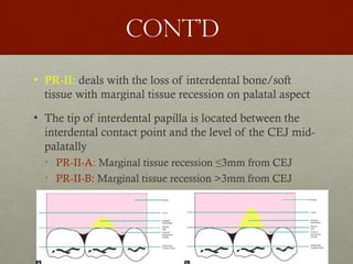 36
Cont’d
• PR-II: deals with the loss of interdental bone/soft
tissue with marginal tissue recession on palatal aspect
• The tip of interdental papilla is located between the
interdental contact point and the level of the CEJ mid-
palatally
• PR-II-A: Marginal tissue recession ≤3mm from CEJ
• PR-II-B: Marginal tissue recession >3mm from CEJ
 