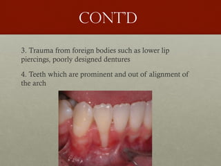 8
Cont’d
3. Trauma from foreign bodies such as lower lip
piercings, poorly designed dentures
4. Teeth which are prominent and out of alignment of
the arch
 