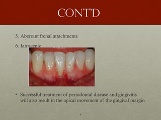 9
Cont’d
5. Aberrant frenal attachments
6. Iatrogenic
• Successful treatment of periodontal disease and gingivitis
will also result in the apical movement of the gingival margin
 