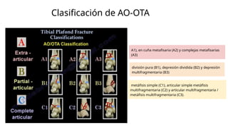 Clasificación de AO-OTA
A1), en cuña metafisaria (A2) y complejas metafisarias
(A3)
división pura (B1), depresión dividida (B2) y depresión
multifragmentaria (B3)
metáfisis simple (C1), articular simple metáfisis
multifragmentaria (C2) y articular multifragmentaria /
metáfisis multifragmentaria (C3).
 