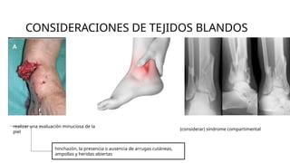 CONSIDERACIONES DE TEJIDOS BLANDOS
realizar una evaluación minuciosa de la
piel
hinchazón, la presencia o ausencia de arrugas cutáneas,
ampollas y heridas abiertas
(considerar) síndrome compartimental
 