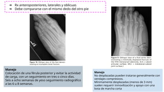 Manejo
No desplazadas pueden tratarse generalmente con
vendajes compresivos.
Mínimamente desplazadas (menos de 3 mm)
suelen requerir inmovilización y apoyo con una
bota de marcha corta
➔ Rx anteroposteriores, laterales y oblicuas
➔ Debe compararse con el mismo dedo del otro pie
Manejo
Colocación de una férula posterior y evitar la actividad
de carga, con un seguimiento en tres o cinco días.
Seis a ocho semanas de yeso seguimiento radiográfico
a las 6 u 8 semanas.
 
