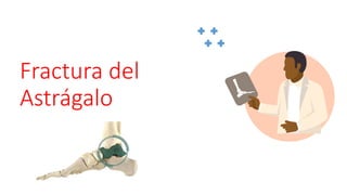 Fractura del
Astrágalo
 