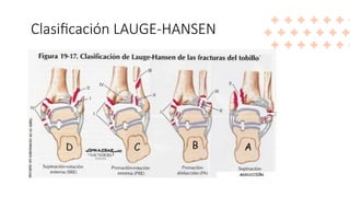 Clasificación LAUGE-HANSEN
It’s the closest planet to
the Sun and the smallest
in the Solar System
Mercury
Venus has a beautiful
name and is the second
planet from the Sun
Venus
 