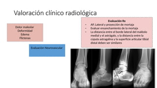 Valoración clínico radiológica
Dolor maleolar
Deformidad
Edema
Flictenas
Evaluación Neurovascular
Evaluación Rx
- AP, Lateral y proyección de mortaja
- Evaluar ensanchamiento de la mortaja
- La distancia entre el borde lateral del maléolo
medial y el astrágalo, y la distancia entre la
cúpula astragalina y la superficie articular tibial
distal deben ser similares
 